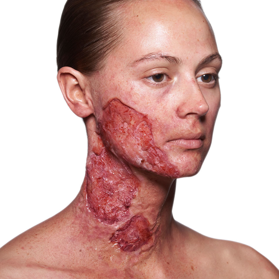 Artex - Image 4
